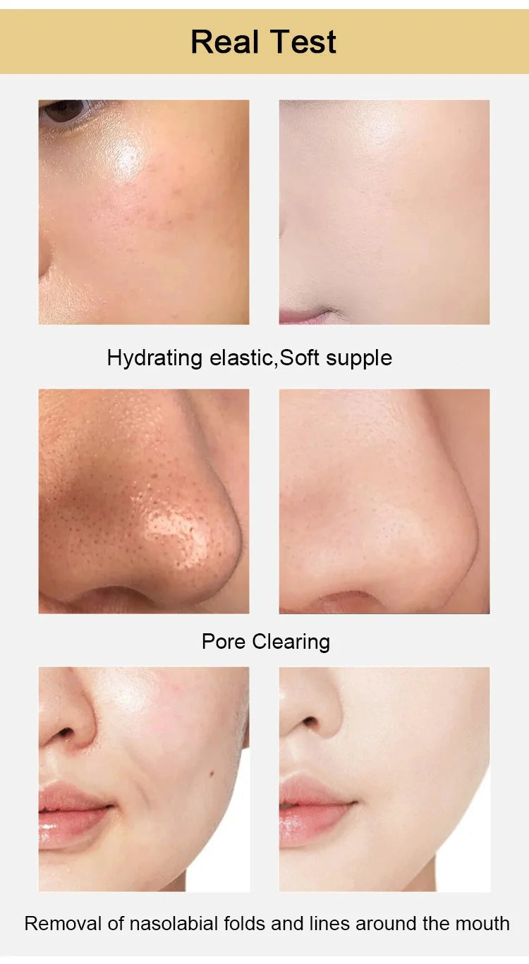 Macadve™ Magical Gold Peel Mask🍕 BYE 1,  GET 1 FREE🎁🎁🎁🎁