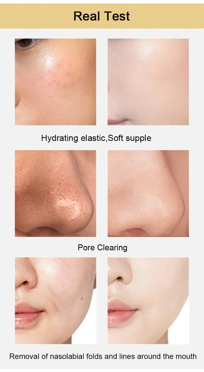 Macadve™ Magical Gold Peel Mask🍕 BYE 1,  GET 1 FREE🎁🎁🎁🎁